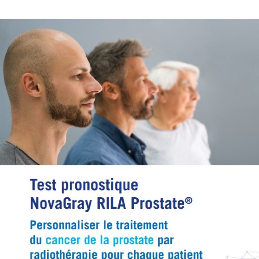 Trois hommes de profils différents illustrant la diversité des patients, accompagnés du message sur le test NovaGray RILA Prostate® pour personnaliser le traitement du cancer de la prostate par radiothérapie.