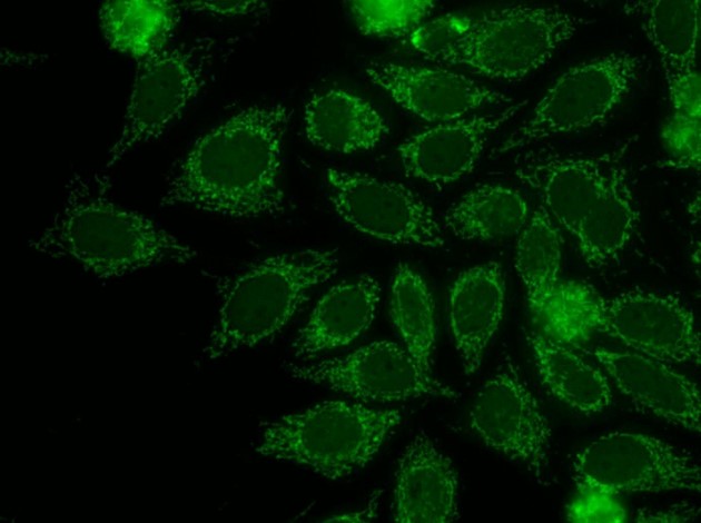 ANTI-MITOCHONDRIE DE TYPE2 (AMA2): suspectés sur Hep2/2000