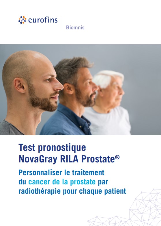Trois hommes de profils différents illustrant la diversité des patients, accompagnés du message sur le test NovaGray RILA Prostate® pour personnaliser le traitement du cancer de la prostate par radiothérapie.