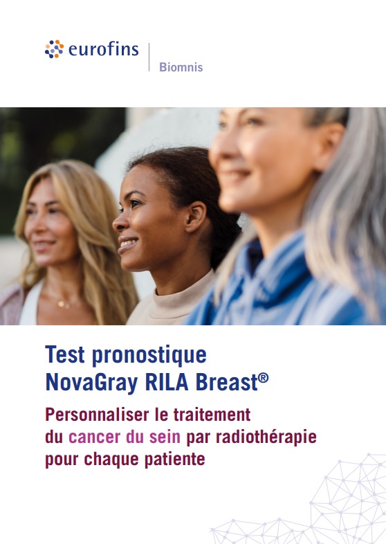 Trois personnes illustrant la diversité, accompagnées du message promotionnel sur le test NovaGray RILA Breast® pour la personnalisation du traitement du cancer du sein par radiothérapie.